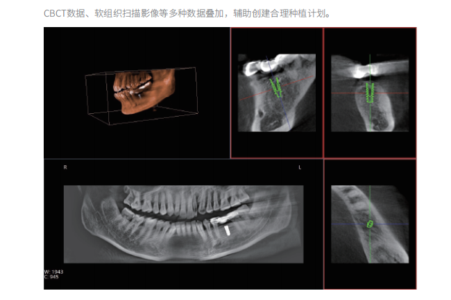 口腔CBCT影像