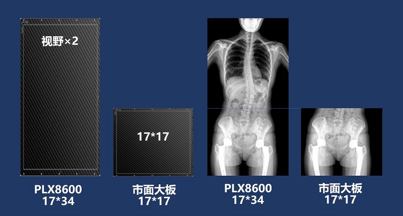 兒童DR拍片不拼接